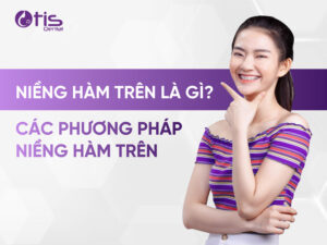 Niềng Răng Hàm Trên Là Gì? Các Phương Pháp Niềng Hàm Trên