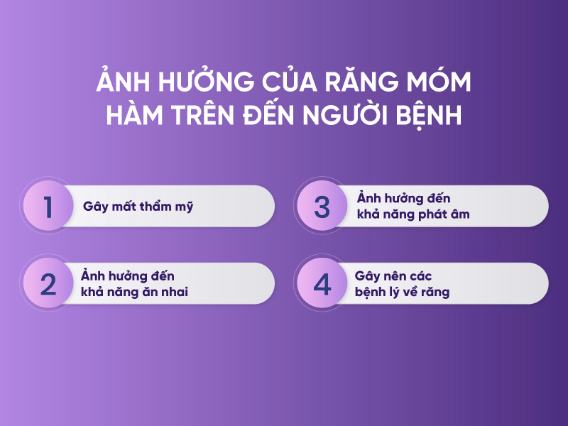 Niềng Răng Móm Hàm Trên Và Những Điều Bạn Cần Biết