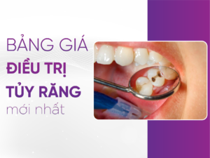 Bảng Giá Điều Trị Tủy Răng Mới Nhất 2025