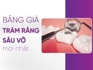 Bảng Giá Trám Răng Mới Nhất 2025