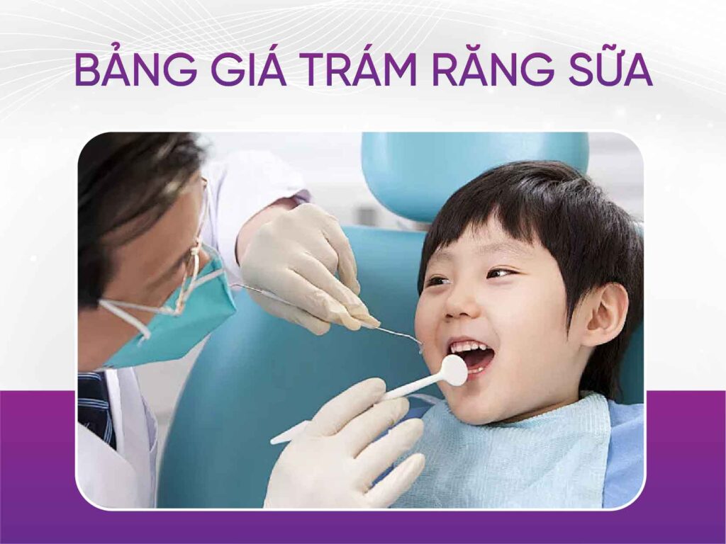 Bảng giá trám răng mới nhất 2025 Bảng Giá Trám Răng Sữa
