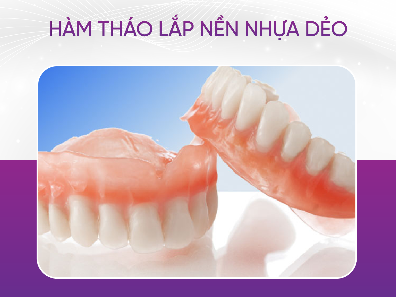 3 loại răng giả hàm tháo lắp phổ biến nhất hiện nay Hàm Tháo Lắp Nền Nhựa Dẻo