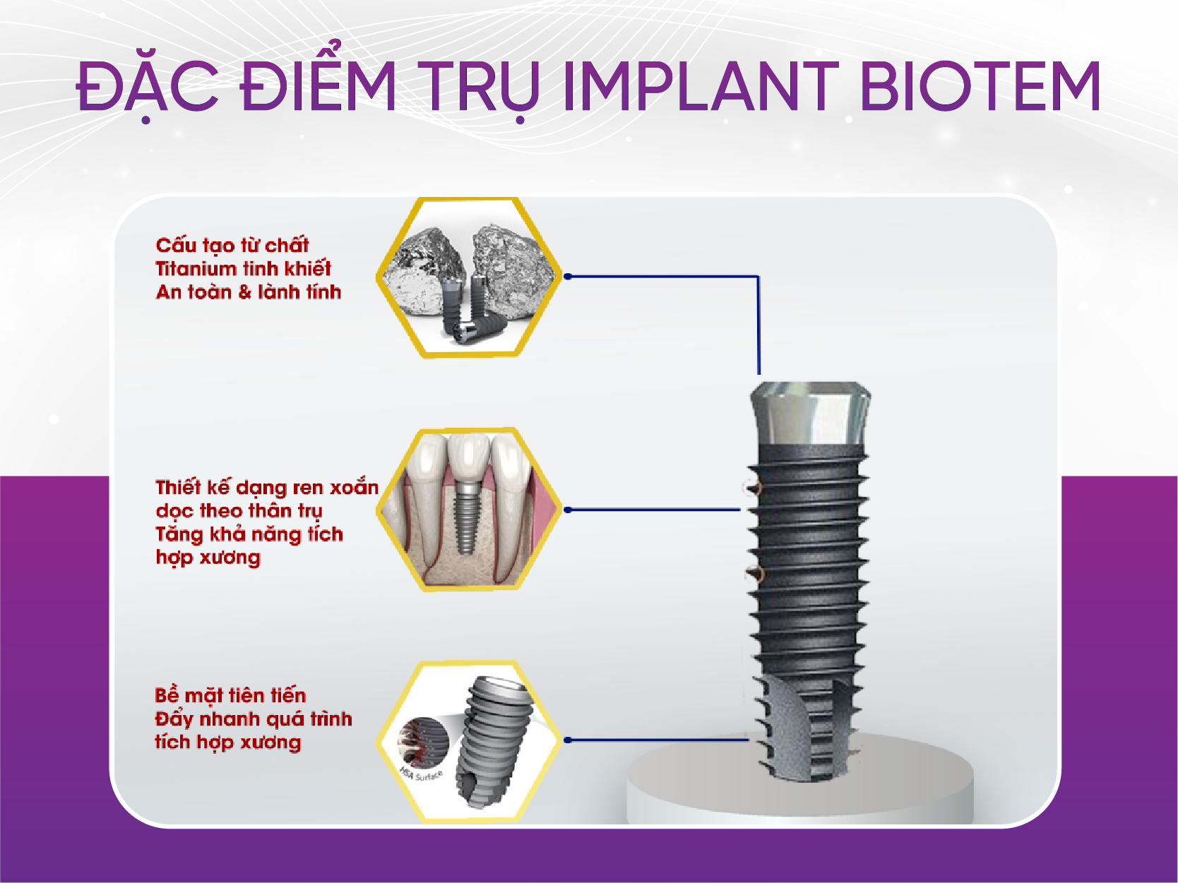 Trụ Implant Biotem và 3 đặc điểm tạo nên sự khác biệt Đặc Điểm Trụ Implant Biotem