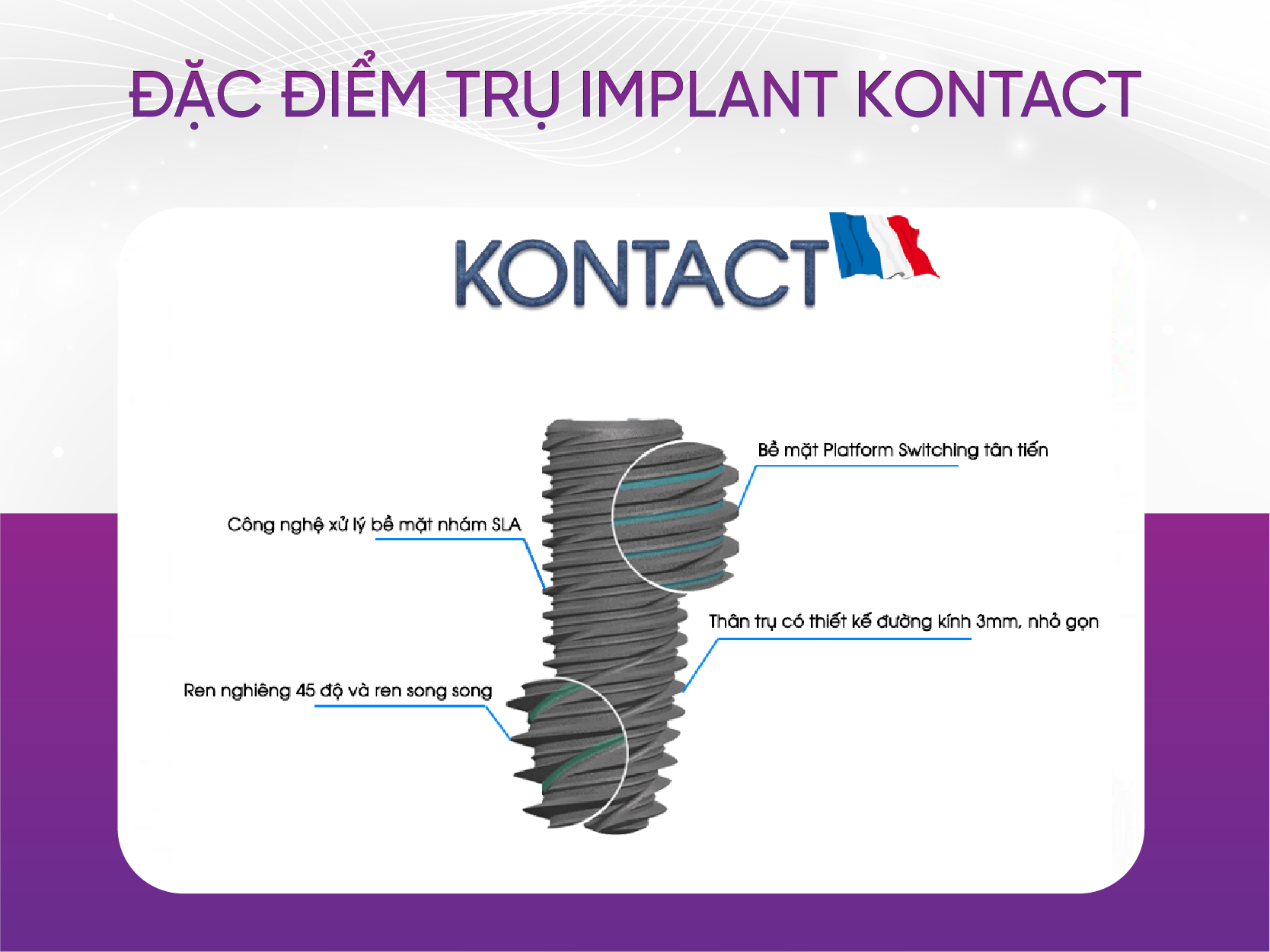 Trụ Implant Kontact và 4 ưu điểm nổi bật Đặc Điểm Trụ Implant Kontact