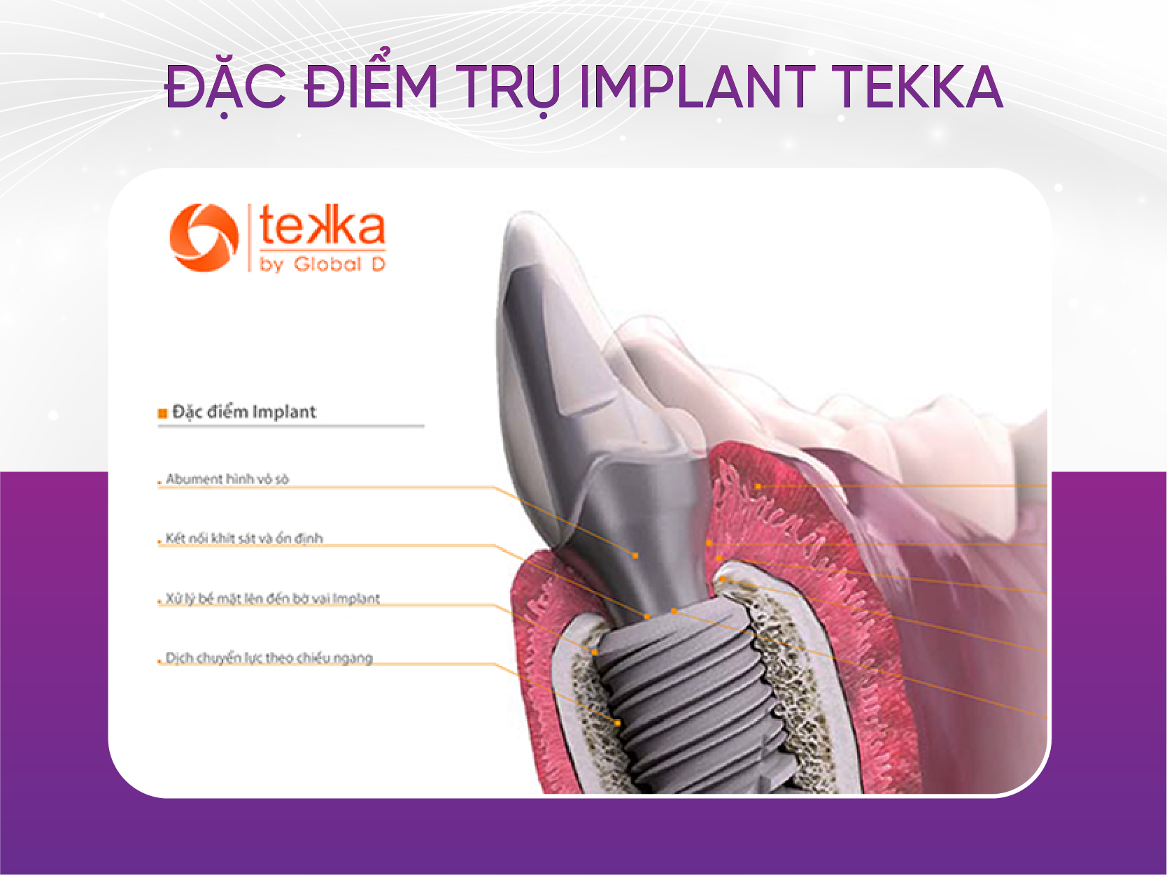 đặc điểm trụ implant tekka