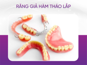 Răng Giả Hàm Tháo Lắp