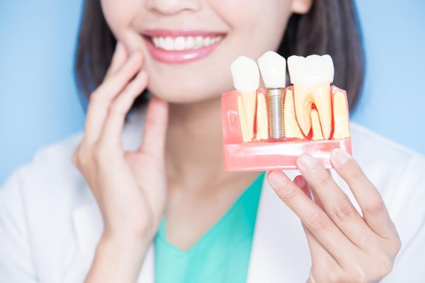 Trụ Implant Hiossen và 4 đặc điểm nổi bật Trụ Implant Hiosen