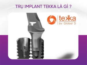 Trụ Implant Tekka Và 5 Đặc Tính Ưu Việt