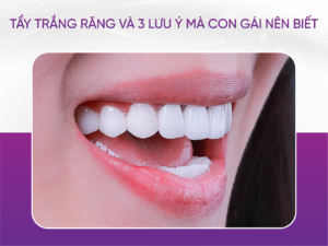 Tẩy Trắng Răng Và 3 Lưu Ý Về Tẩy Trắng Răng Con Gái Nên Biết