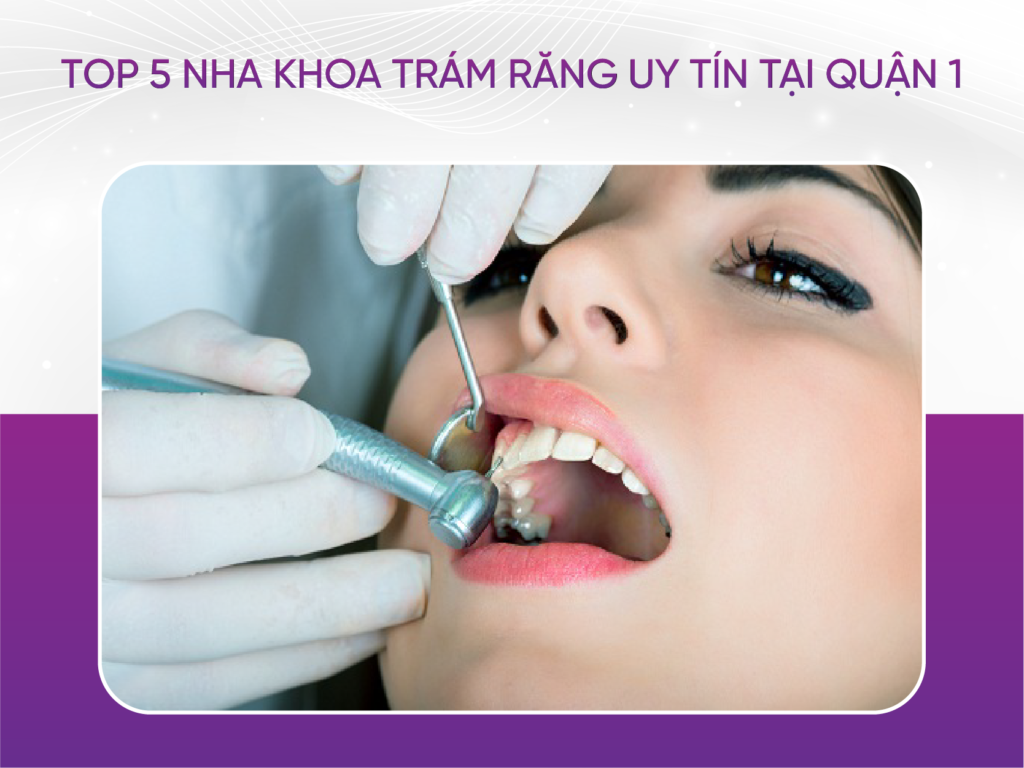Top 5 nha khoa trám răng uy tín tại Quận 1 Top 5 Nha Khoa Trám Răng Uy Tín Tại Quận 1