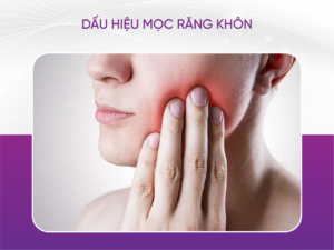 5 Dấu Hiệu Mọc Răng Khôn Bạn Cần Biết