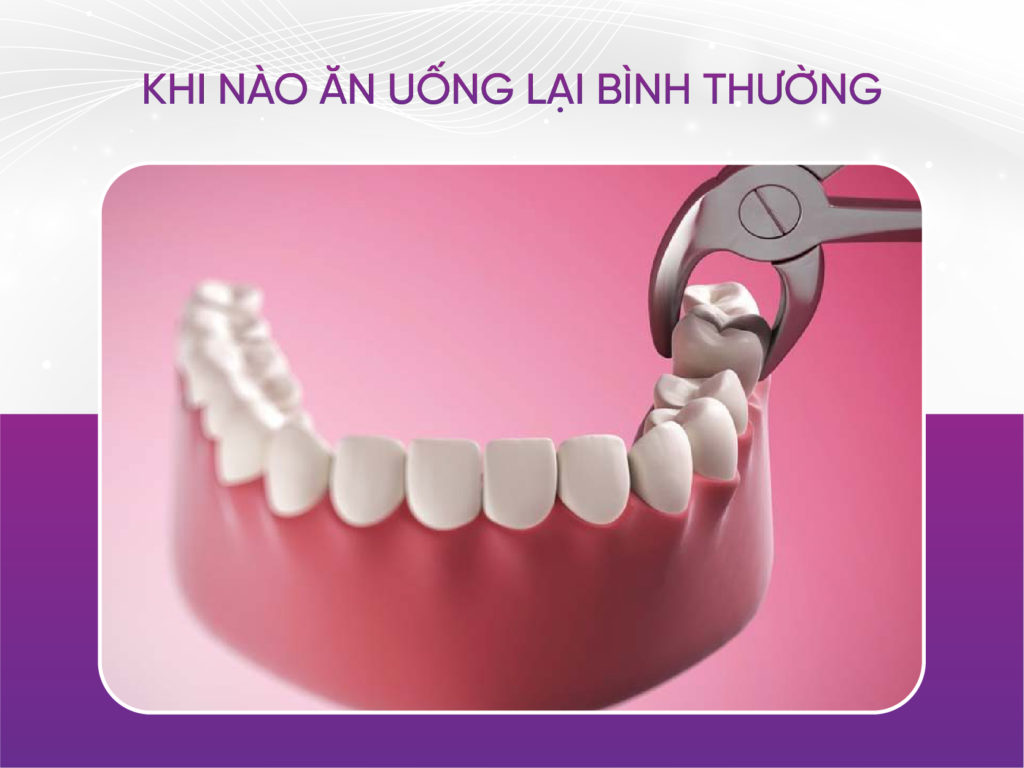 Nhổ Răng Khôn Sau Bao Lâu Thì Ăn Lại Bình Thường