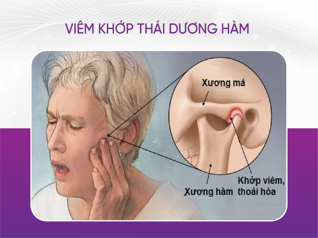 TOP 5 nha khoa điều trị viêm khớp thái dương hàm uy tín tại Hồ Chí Minh Top 5 Nha Khoa Điều Trị Viêm Khớp Thái Dương Hàm Uy Tín Tại Hồ Chí Minh