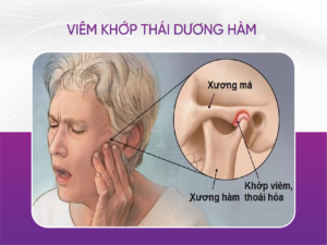 Top 5 Nha Khoa Điều Trị Viêm Khớp Thái Dương Hàm Uy Tín Tại Hồ Chí Minh