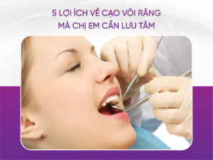5 Lợi Ích Về Cạo Vôi Răng Mà Chị Em Cần Lưu Tâm