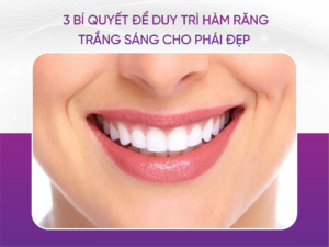3 Bí Quyết Để Duy Trì Hàm Răng Trắng Sáng Cho Phái Đẹp