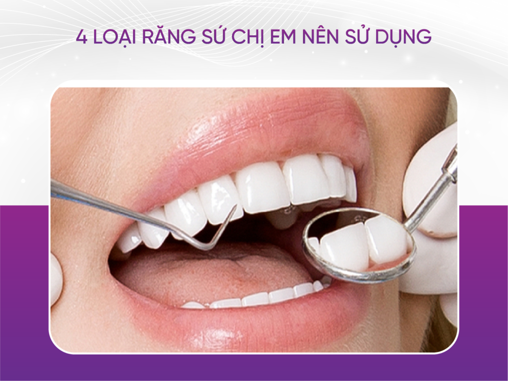 4 Loại Răng Sứ Chị Em Nên Sử Dụng