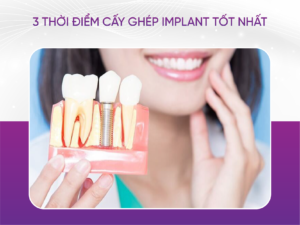 3 Thời Điểm Cấy Ghép Implant Tốt Nhất Mà Chị Em Nên Biết