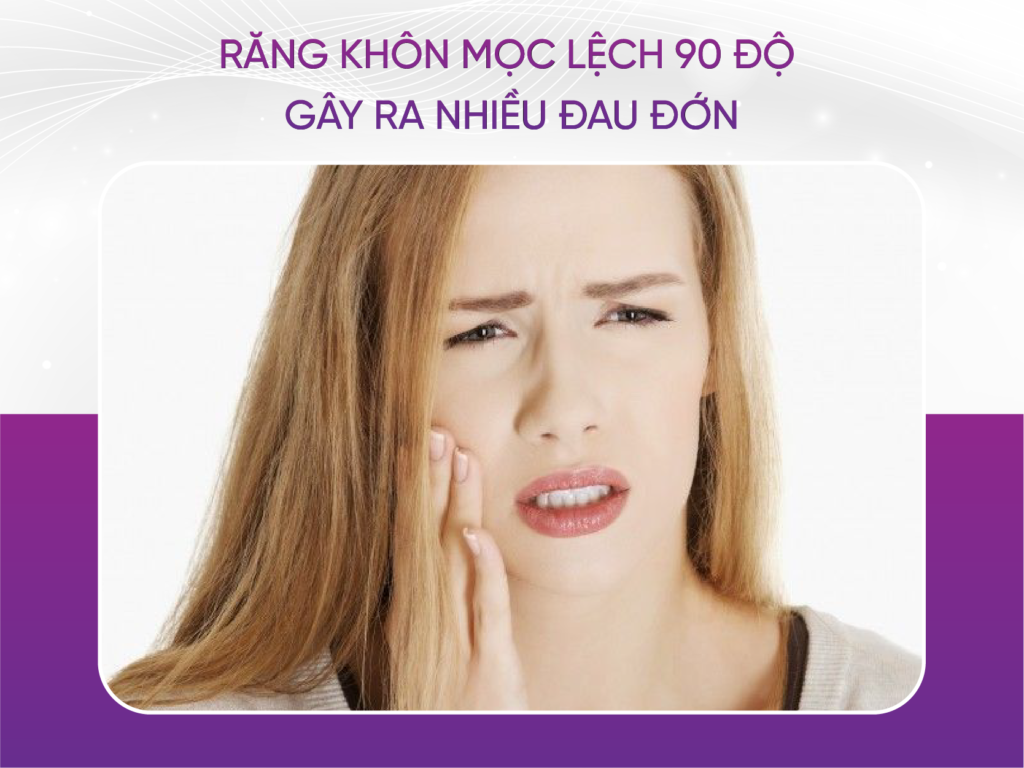 Những điều cần lưu ý về răng khôn mọc lệch 90 độ Răng Khôn Mọc Lệch 90 Độ Gây Ra Nhiều Đau Đớn