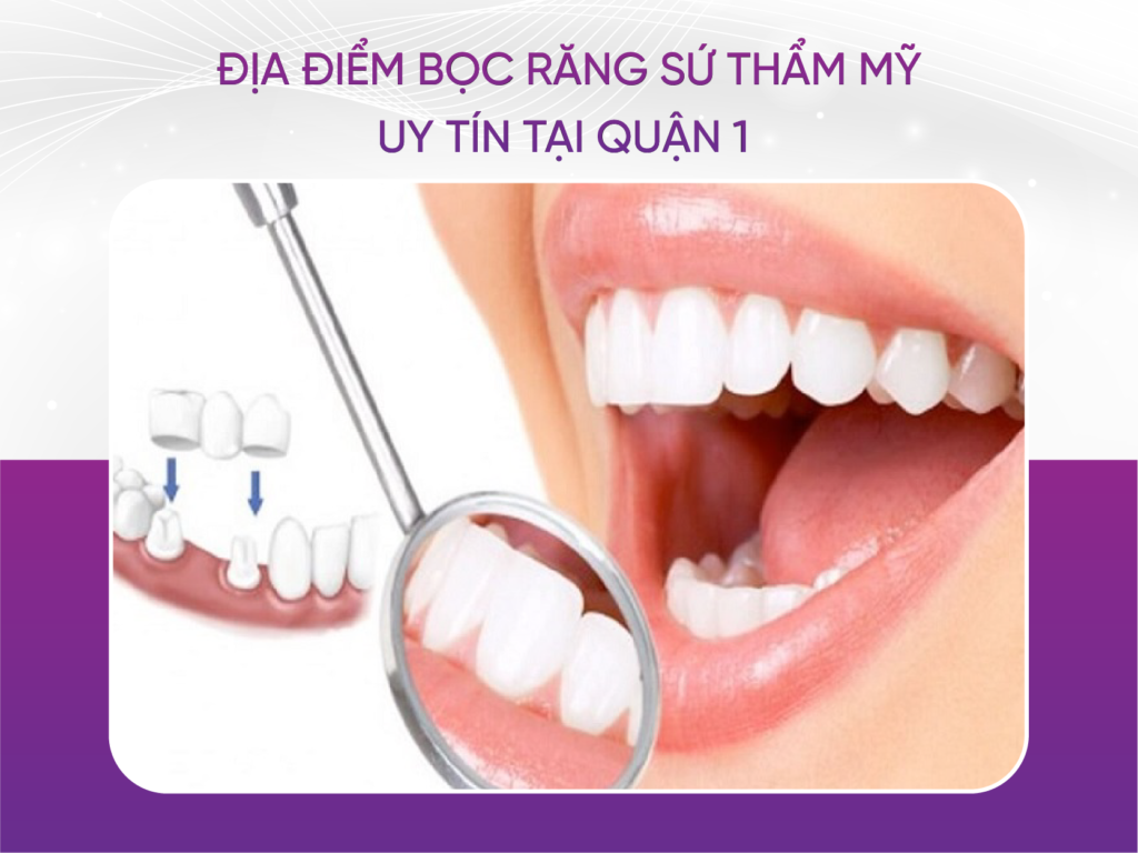 Top những nha khoa bọc răng sứ thẩm mỹ uy tín tại Quận 1 Địa Điểm Bọc Răng Sứ Thẩm Mỹ Uy Tín Tại Quận 1