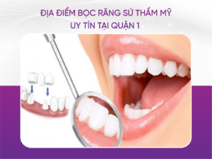 Địa Điểm Bọc Răng Sứ Thẩm Mỹ Uy Tín Tại Quận 1