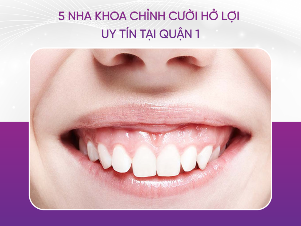 5 Nha Khoa Chỉnh Cười Hở Lợi Uy Tín Tại Quận 1