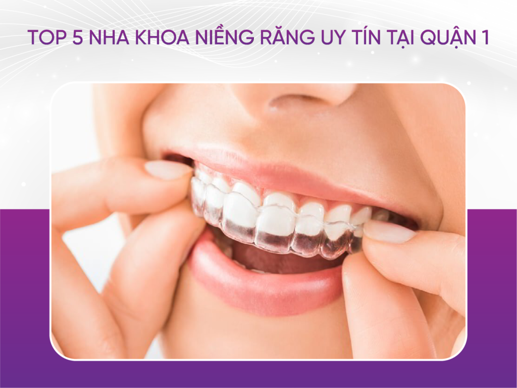 Niềng Răng Trong Suốt: Giá Cả Và Địa Chỉ Nha Khoa Uy Tín Top 5 Nha Khoa Niềng Răng Uy Tín Tại Quận 1