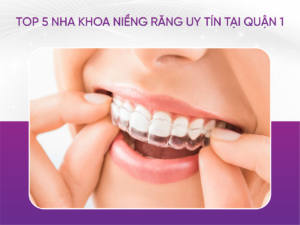 Top 5 Nha Khoa Niềng Răng Uy Tín Tại Quận 1