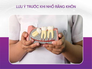 Lưu Ý Trước Khi Nhổ Răng Khôn