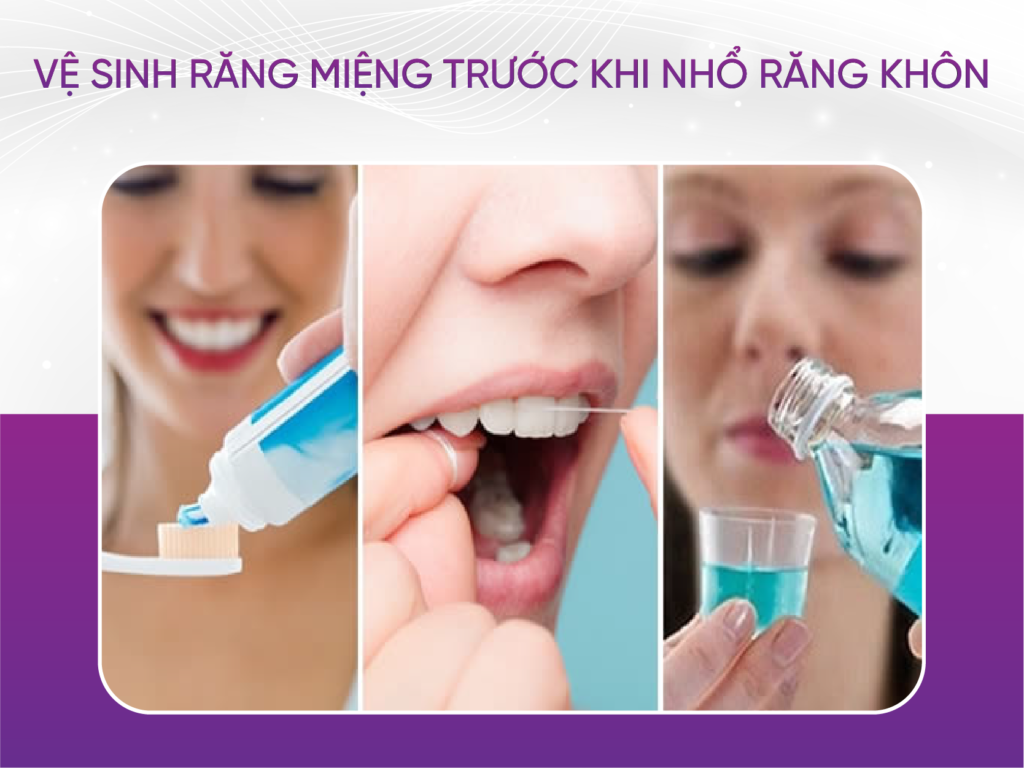 4 điều cần biết trước khi nhổ răng khôn Vệ Sinh Răng Miệng Trước Khi Nhổ Răng Khôn