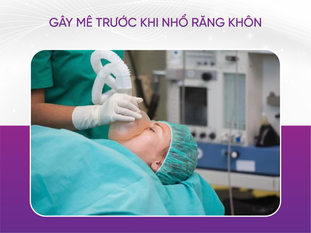 4 điều cần biết trước khi nhổ răng khôn Gây Mê Trước Khi Nhổ Răng Khôn