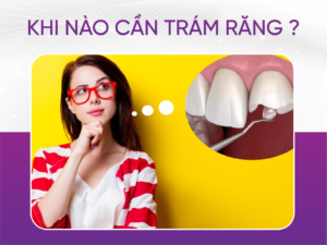Khi Nào Cần Trám Răng