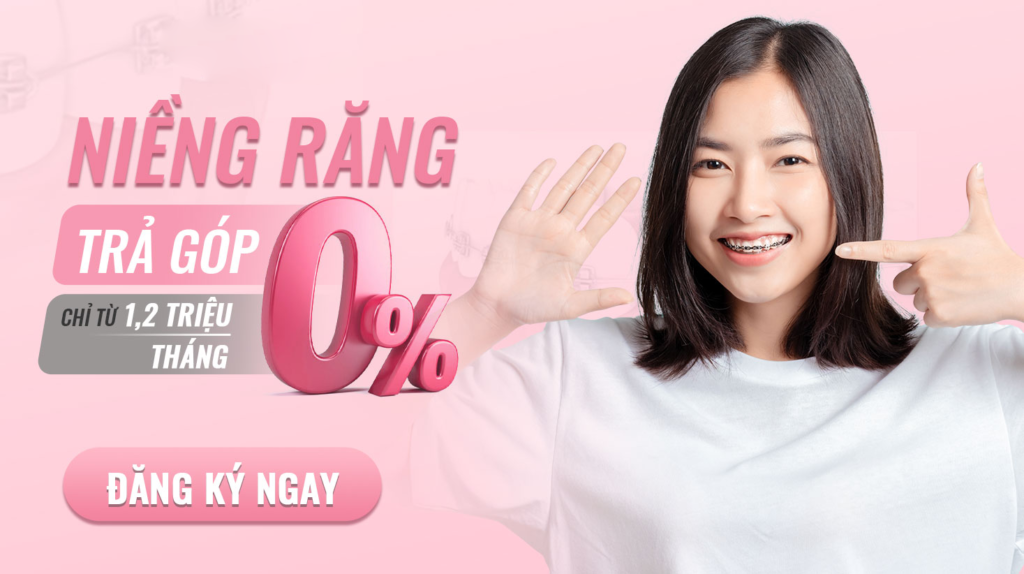 Niềng răng trả góp: 5 điều cần biết để lựa chọn dịch vụ tốt nhất Niềng Răng Trả Góp