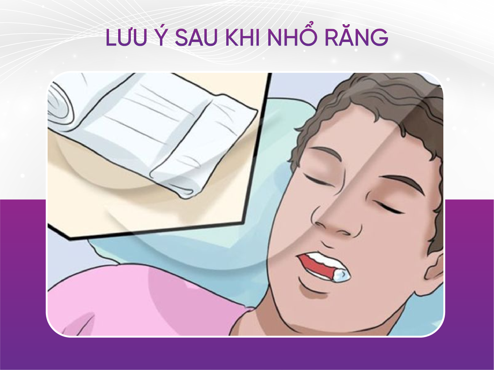 lưu ý sau khi nhổ răng