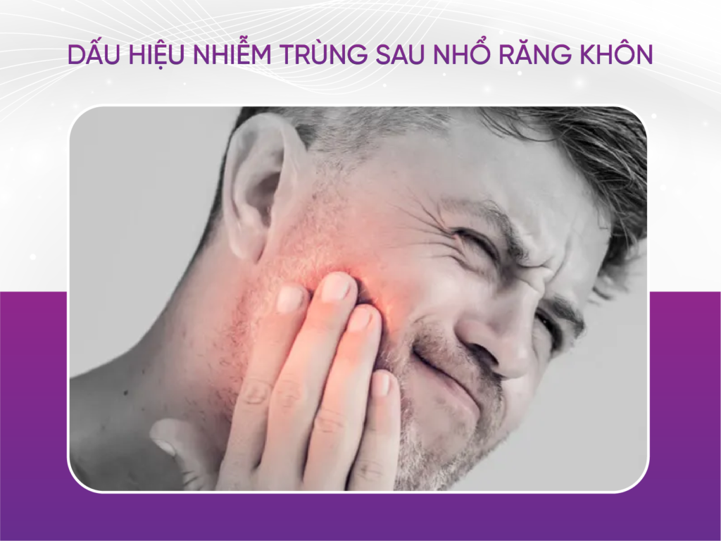 Nhiễm trùng sau khi nhổ răng khôn và 8 điều dấu hiệu nhận biết Nhiễm Trùng Sau Nhổ Răng Khôn