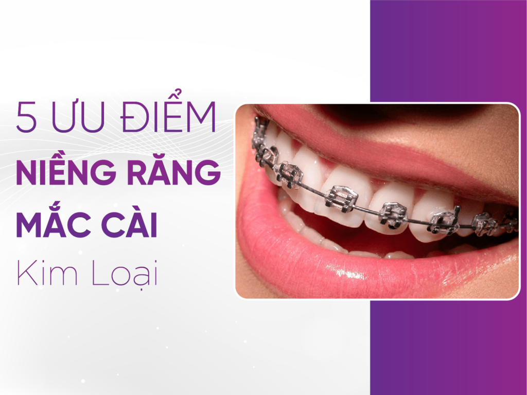 Nieng-Rang-Mac-Cai-Kim-Loai