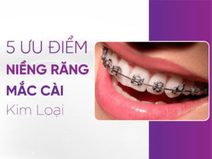 Nieng-Rang-Mac-Cai-Kim-Loai