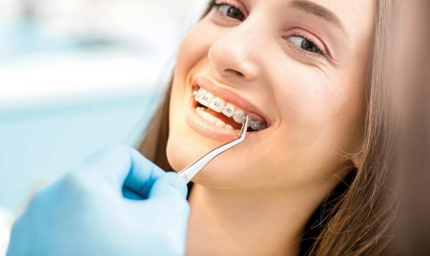 Niềng răng 1 hàm và 5 điều cần biết trước khi điều trị Niềng Răng 1 Hàm Và 5 Điều Cần Biết Trước Khi Điều Trị