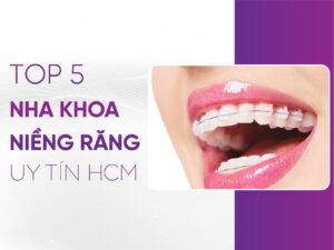 Niềng Răng Uy Tín Hcm - Top 5 Nha Khoa