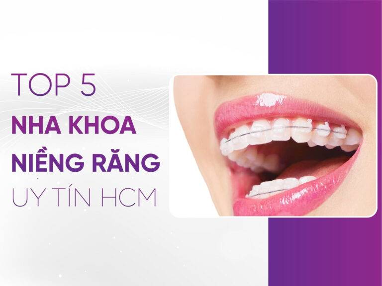 Niềng Răng Uy Tín Hcm - Top 5 Nha Khoa