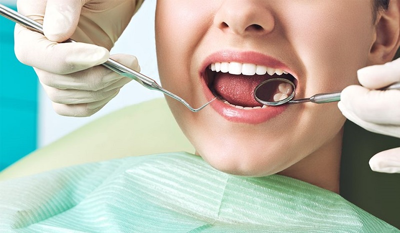 Chi phí nhổ răng khôn có bảo hiểm y tế? 3 tiêu chí được hưởng BHYT Chi Phí Nhổ Răng Khôn Có Bảo Hiểm Y Tế? 3 Tiêu Chí Được Hưởng Bhyt