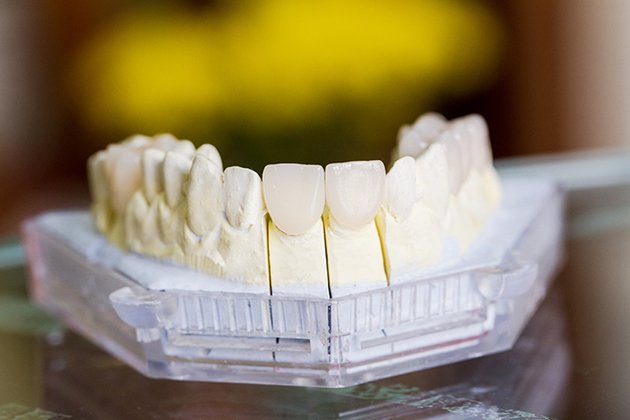 Răng sứ zirconia là gì? 5 ưu điểm vượt trội của răng sứ zirconia