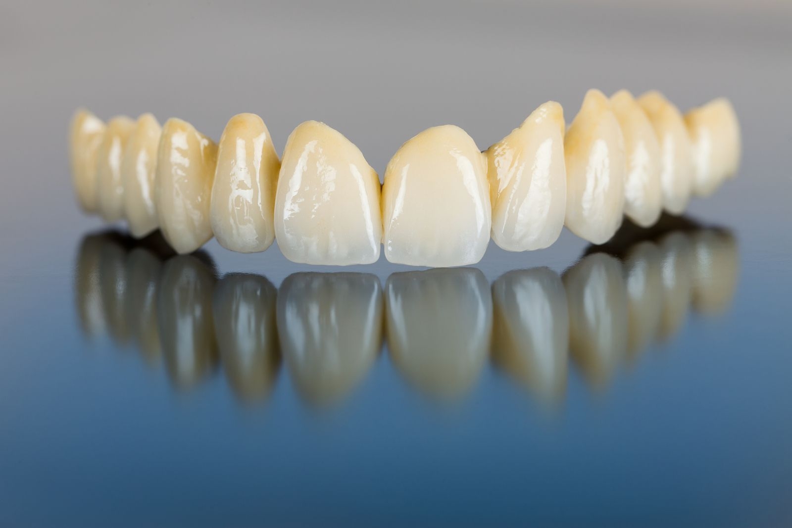Răng sứ zirconia là gì? 5 ưu điểm vượt trội của răng sứ zirconia