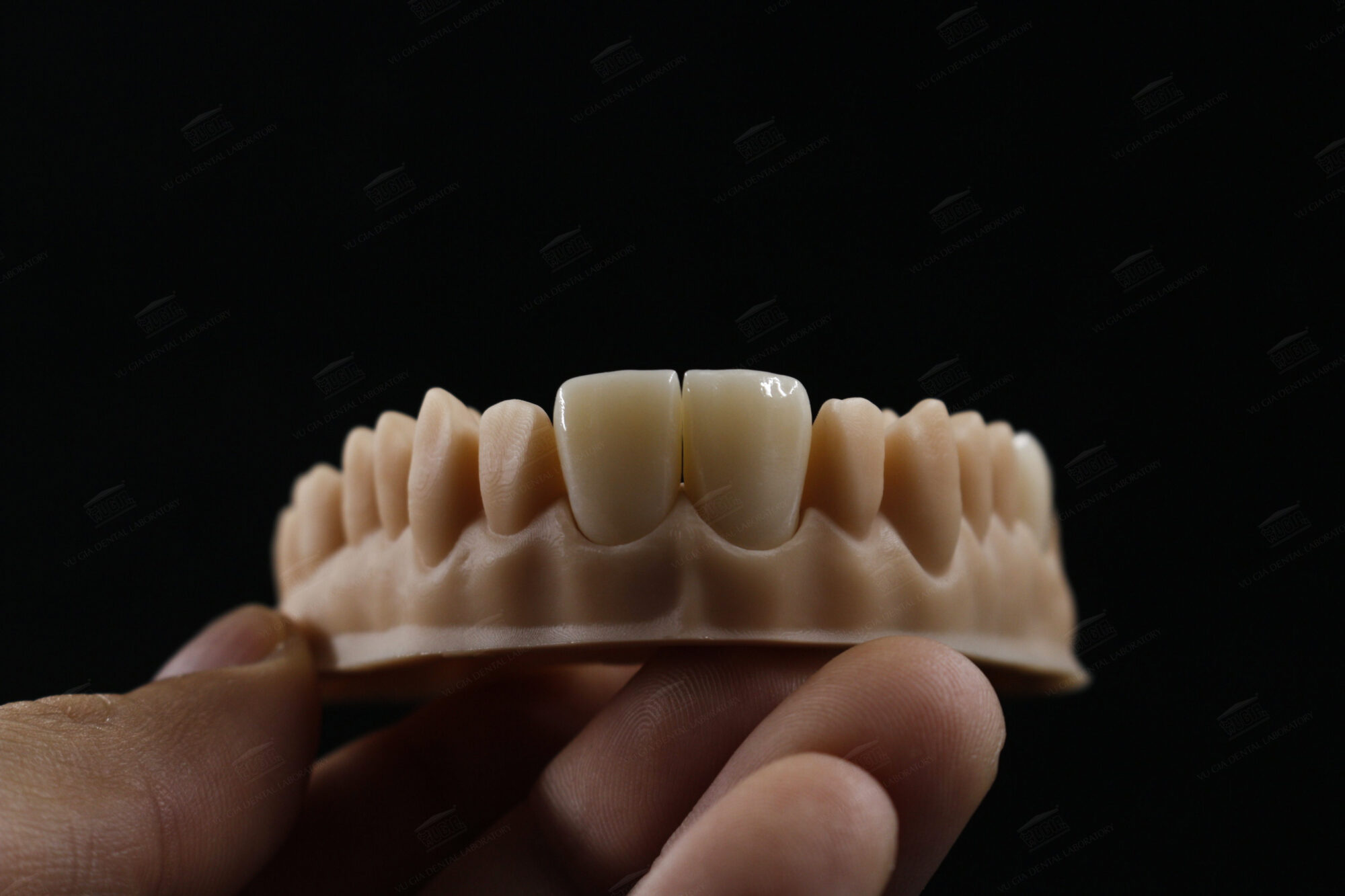 Răng sứ zirconia là gì? 5 ưu điểm vượt trội của răng sứ zirconia