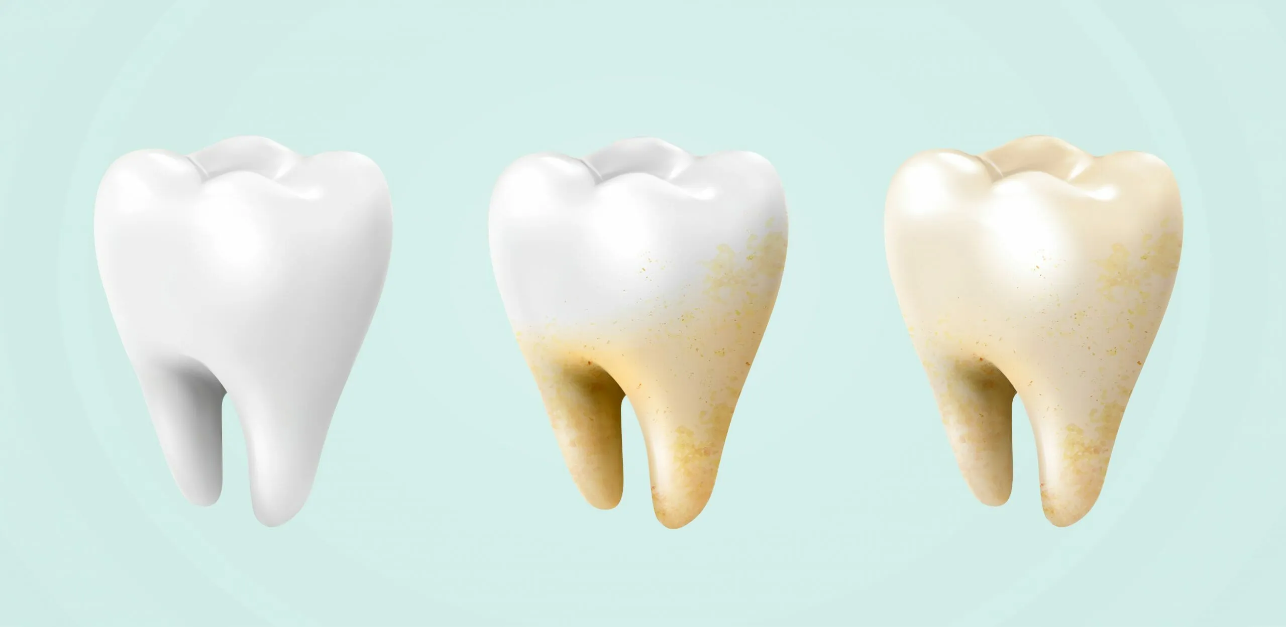Tẩy trắng răng: Quy trình và chi phí mới nhất 2024