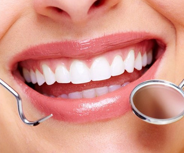 Trám răng thẩm mỹ là gì? 3 yếu tố ảnh hưởng đến chi phí