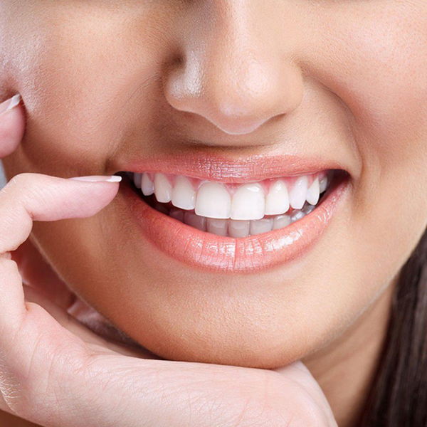 Trám răng thẩm mỹ là gì? 3 yếu tố ảnh hưởng đến chi phí