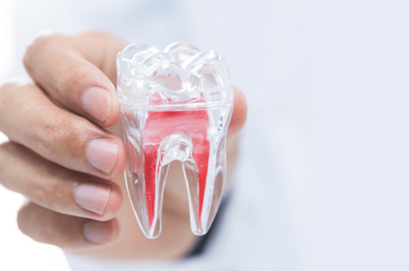 Trám răng và lấy tủy giá bao nhiêu? Bảng giá chi tiết mới nhất 2024