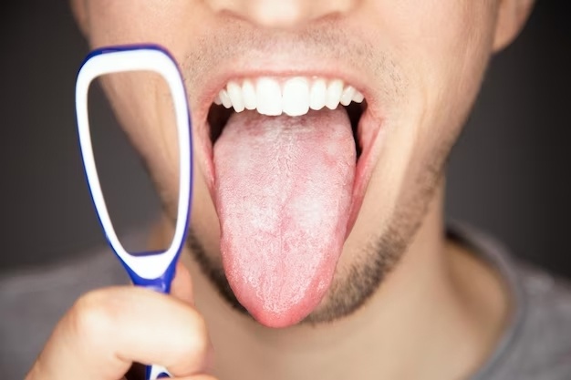Hôi miệng: Nguyên nhân và 5 cách điều trị hiệu quả nhất