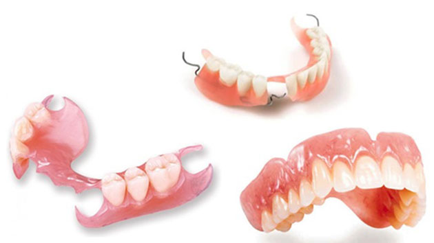Mất răng và 4 giải pháp phục hồi tốt nhất